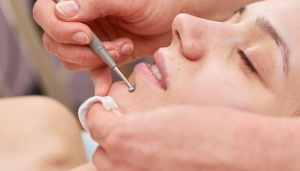 Как да премахнем черните точки?