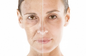 Как действа хиалуроновата киселина на кожата?