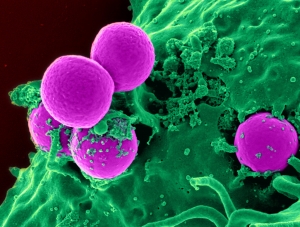 Откриха имунна клетка, която унищожава рака