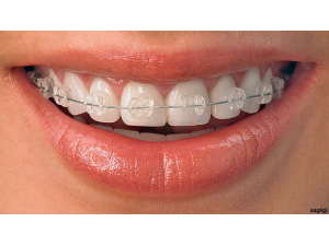 Д-р Валентина Давидова – Специалист Ортодонт