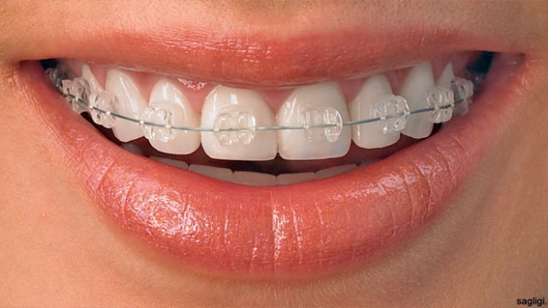 Д-р Валентина Давидова – Специалист Ортодонт