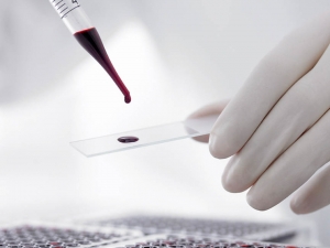 Д-р Калина Игнатова - Клинична хематология гр. София