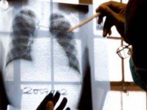 Д-р Маринов - пулмолог гр. Пловдив.