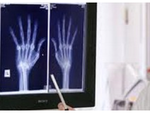 Д-р Камен Клинканов -  ревматолог гр. Пловдив