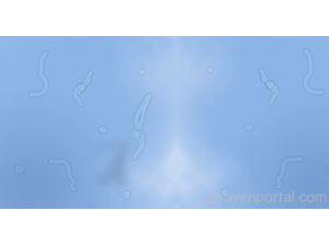 Какви са тези странни неща, които виждате да плуват в очите Ви?