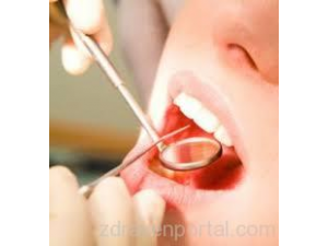 Д-р Акън Зекериев Османов - Стоматолог гр. Казанлък