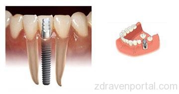 Д-р Явор Хаджиев - Стоматолог гр. София