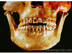 Зъболечението може да се окаже една от най-древните професии