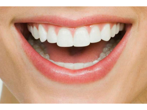 Топ съвети за бели зъби и здрави венци