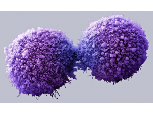 Учени откриха начин да „изключват” рака