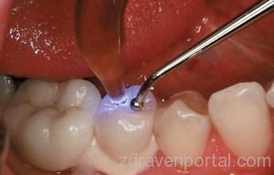 Д-р Лора Арсова - Стоматолог гр. Монтана