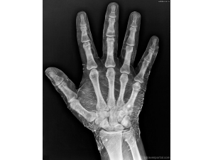 Д-р Валентин Вълков - Рентгенолог гр. Балчик