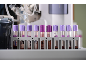 Нов тест за ракови заболявания използва само една капка кръв