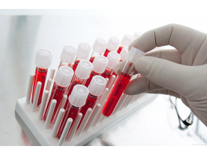 Нов кръвен тест засича, класифицира и определя местоположението на ракови образувания