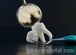 Д-р Донка Станчева-Забуртова – Дентална медицина гр. София