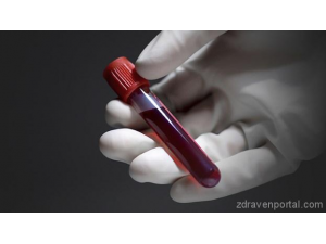 Кръвен тест допринася за намаляване на ненужната употреба на антибиотици