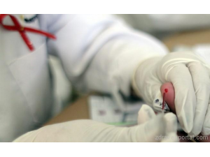 Немски учени с напредък в лечението на ХИВ