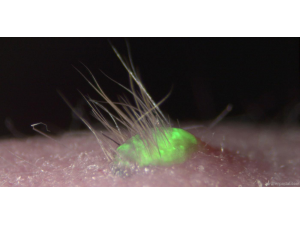 За първи път коса поникна върху изкуствена кожа