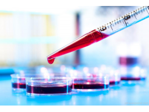 Кръвен тест може да идентифицира причините за тежки заболявания