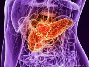 Пробив: Ракът на панкреаса вече се поддава на лечение