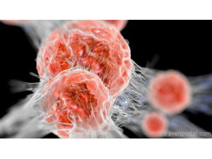 Създадено е лекарство срещу меланома