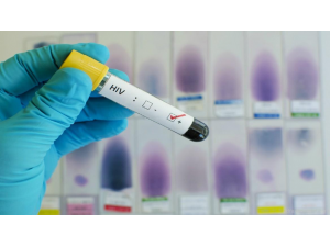 Все по-близо до пълното излекуване на СПИН