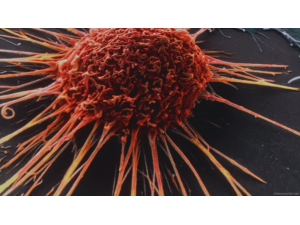 Лекари изпробват нов метод срещу рак на простатата