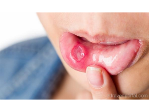 Афти - какво не знаем за тях?