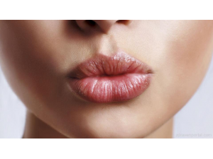 Сухи и напукани устни – какво ги причинява?