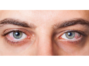 5 начина за предотвратяване на сухота в очите