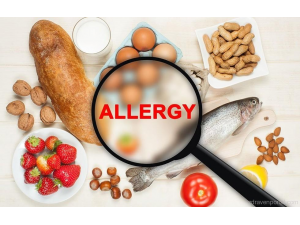 Хранителна алергия - кои са най-честите причини ?