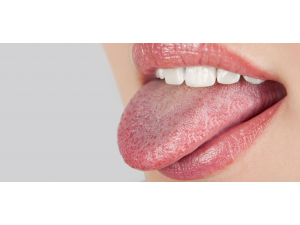 Сухота в устата и в очите ?