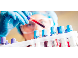 Обещаващ кръвен тест за ранното откриване на рак
