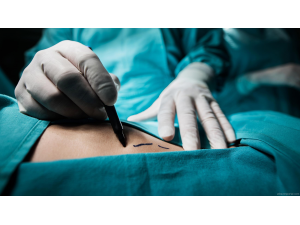 Български лекари спасиха 4-месечно бебе с огромен тумор