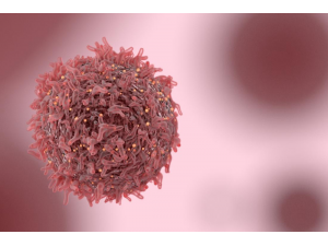 Все повече млади са с рак на дебелото черво