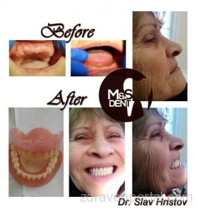 1b5eba0c6e0fb77b22bbc82377128d18-600x0_R