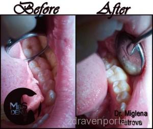 319cef4efaa7bf3916b28a42eca151d0-600x0_R